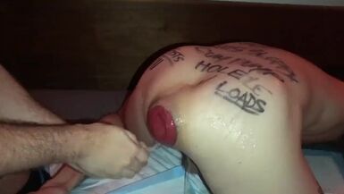 Prolapsed Bottom is Punched Hard. Homosexual Punch-fisting