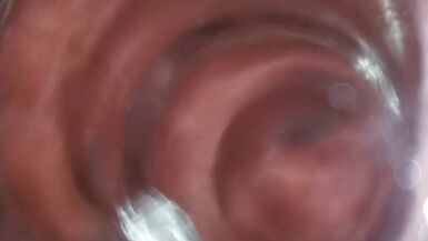 See Inside My Asshole with My Glass Butt Plug