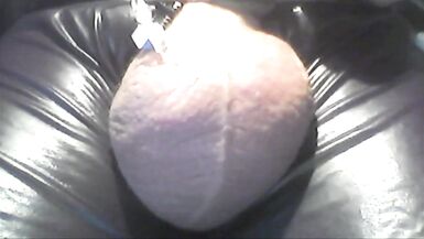 Saline-glucose infusion timelapse.