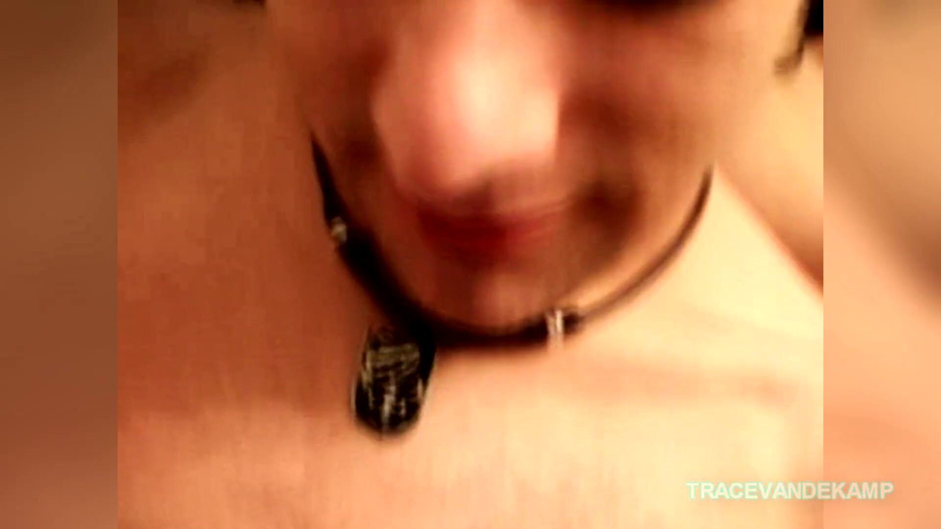 nudist photos boysphimosis boys"